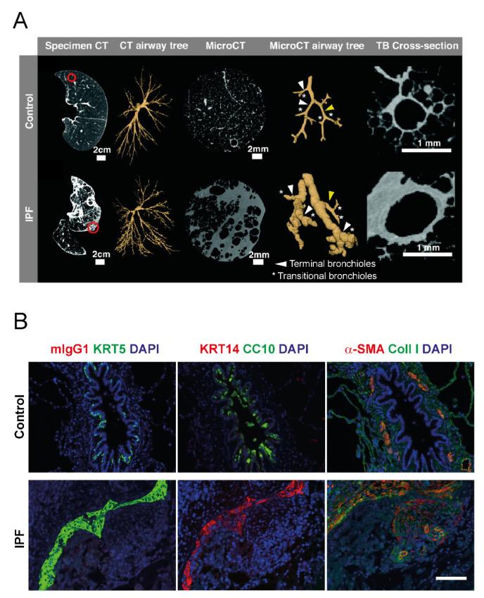 https://cdn.ncbi.nlm.nih.gov/pmc/blobs/988e/8947093/849c00285070/cells-11-01050-g002.jpg
