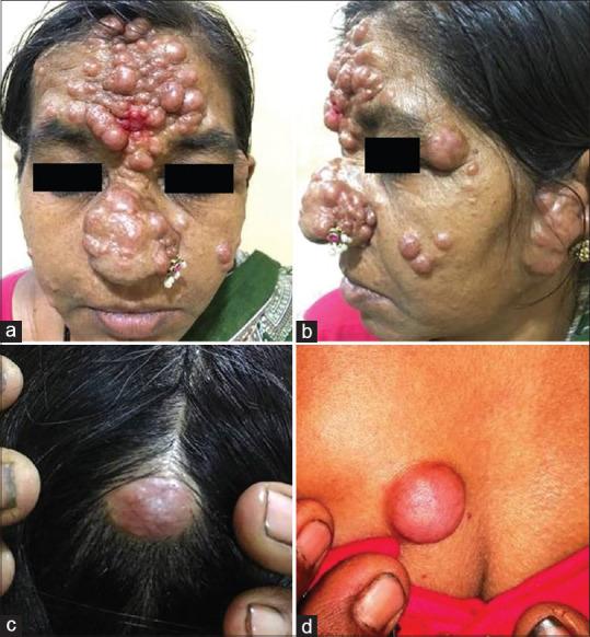 https://cdn.ncbi.nlm.nih.gov/pmc/blobs/98a4/10115342/181e1a61d399/IDOJ-14-303-g001.jpg