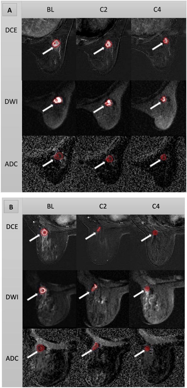 https://cdn.ncbi.nlm.nih.gov/pmc/blobs/98ab/11239818/9d13b22c8f84/41598_2024_66220_Fig3_HTML.jpg