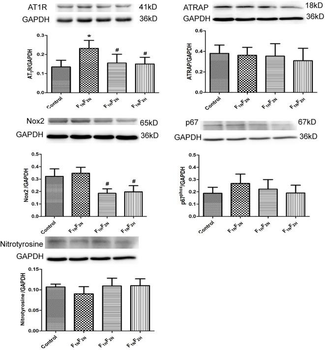 https://cdn.ncbi.nlm.nih.gov/pmc/blobs/98af/7518068/519412a92f08/fphar-11-565726-g006.jpg