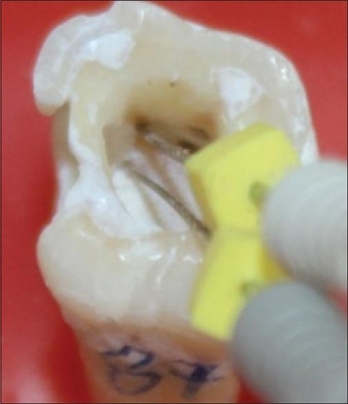 https://cdn.ncbi.nlm.nih.gov/pmc/blobs/98b6/5706321/3e94c4299a3e/JCD-20-190-g002.jpg
