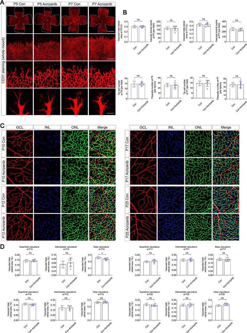 https://cdn.ncbi.nlm.nih.gov/pmc/blobs/98b8/10768700/65d1164cb3f9/tvst-13-1-1-f001.jpg