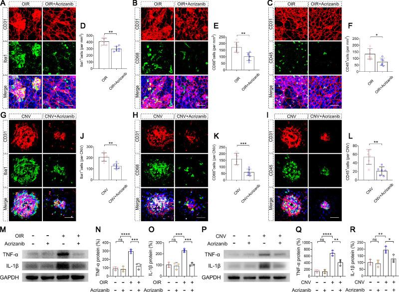 https://cdn.ncbi.nlm.nih.gov/pmc/blobs/98b8/10768700/6a53ec53b304/tvst-13-1-1-f006.jpg