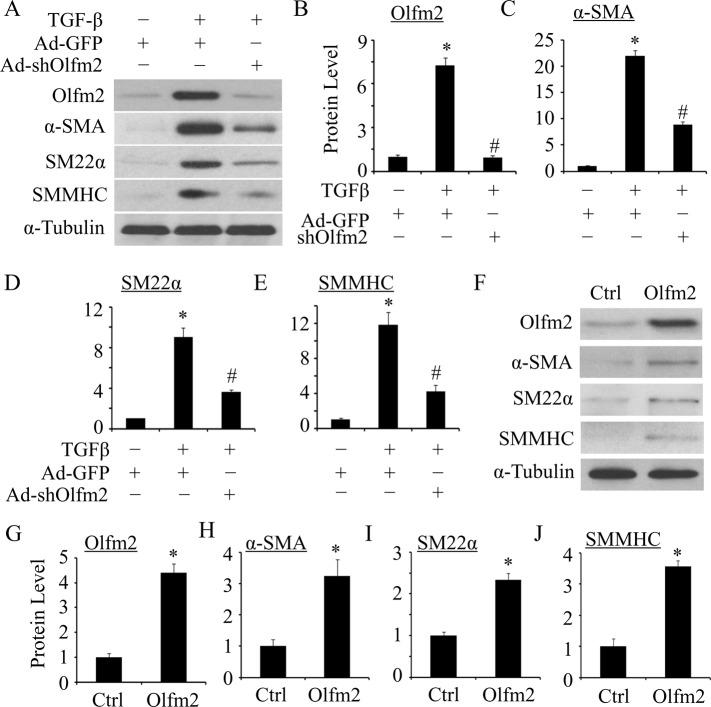 https://cdn.ncbi.nlm.nih.gov/pmc/blobs/98bb/4263453/84f50f0fe526/4106fig2.jpg