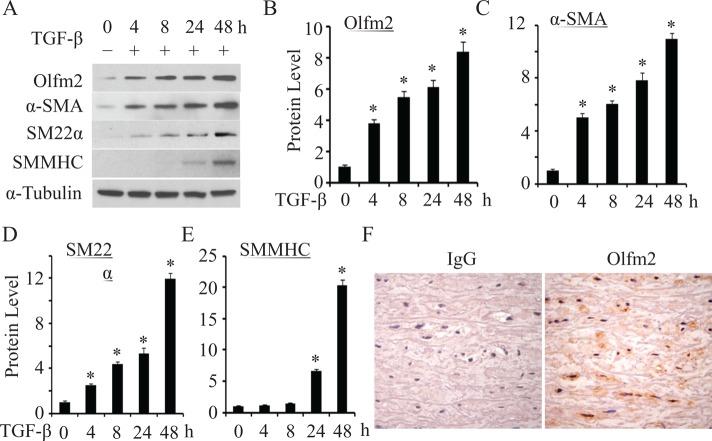 https://cdn.ncbi.nlm.nih.gov/pmc/blobs/98bb/4263453/bbd5a28e74b1/4106fig1.jpg