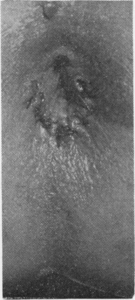 https://cdn.ncbi.nlm.nih.gov/pmc/blobs/98be/1545187/eeb54f4862f2/archdisch00797-0075-a.jpg