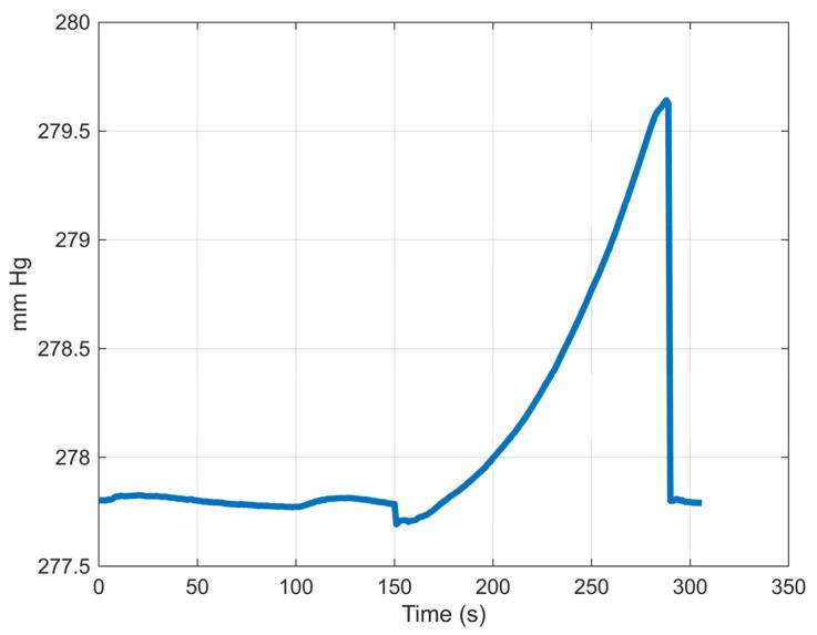 https://cdn.ncbi.nlm.nih.gov/pmc/blobs/98c1/12293007/a4eaf65881ef/bioengineering-12-00676-g006.jpg