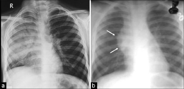 https://cdn.ncbi.nlm.nih.gov/pmc/blobs/98c5/3439789/b7ab06e49700/IJMPO-33-123-g004.jpg