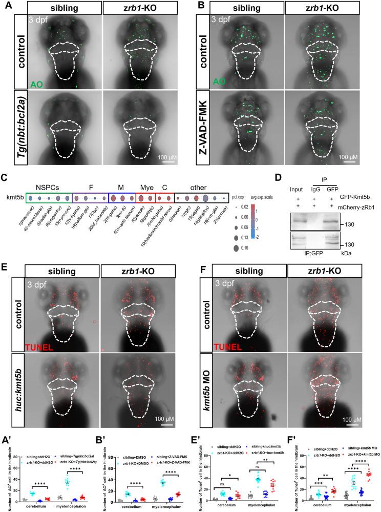 https://cdn.ncbi.nlm.nih.gov/pmc/blobs/98c9/11026443/d9df6a65056d/41420_2024_1955_Fig5_HTML.jpg
