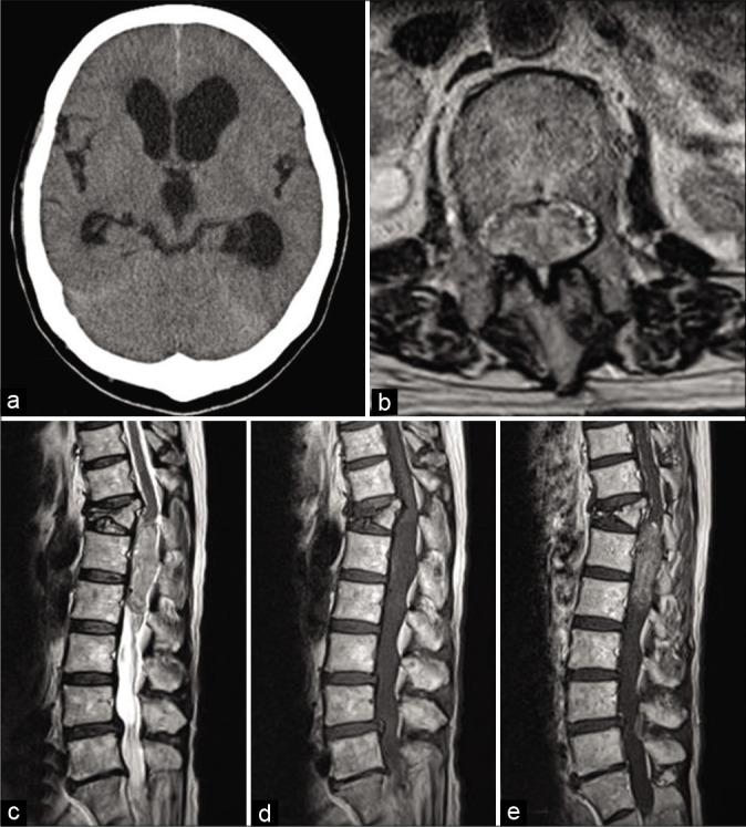 https://cdn.ncbi.nlm.nih.gov/pmc/blobs/98c9/7827580/7278eaf1237c/SNI-12-8-g004.jpg