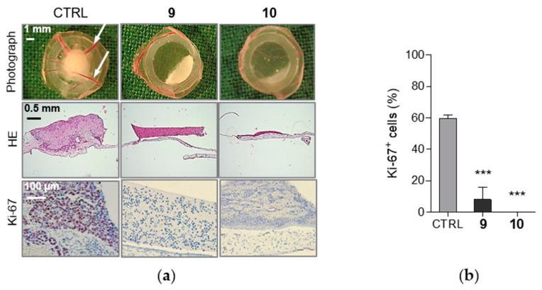 https://cdn.ncbi.nlm.nih.gov/pmc/blobs/98d4/7279329/700247cb8678/ijms-21-03416-g005.jpg