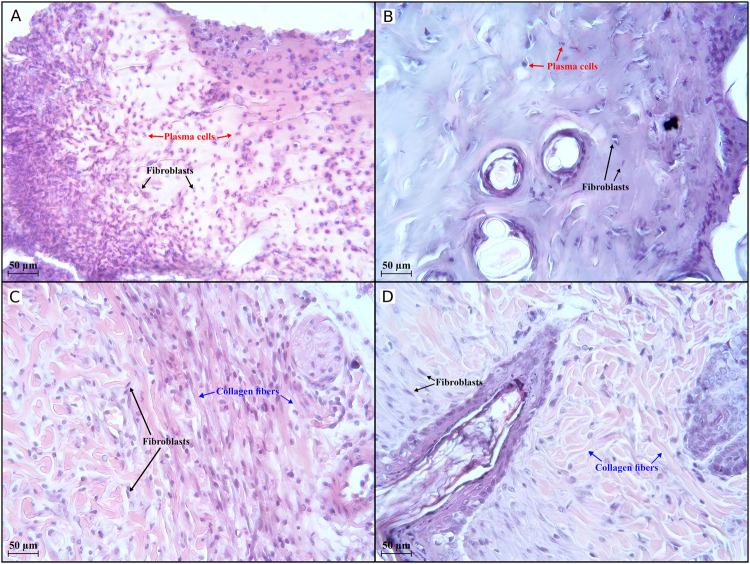 https://cdn.ncbi.nlm.nih.gov/pmc/blobs/98db/11936752/2237261905de/jpps-28-13831-g005.jpg