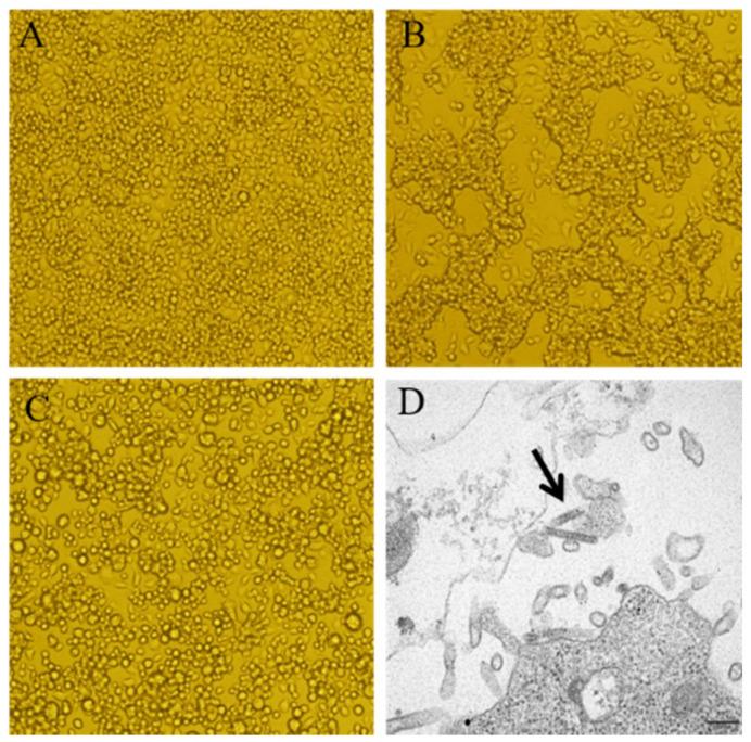 https://cdn.ncbi.nlm.nih.gov/pmc/blobs/98db/9230728/c46f23a2fa90/pathogens-11-00624-g001.jpg