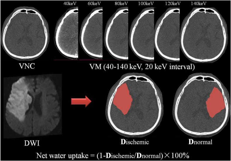 https://cdn.ncbi.nlm.nih.gov/pmc/blobs/98dc/10758880/c83b0ecb4ca6/gr2.jpg