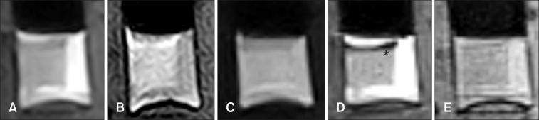 https://cdn.ncbi.nlm.nih.gov/pmc/blobs/98dc/4808634/1bc1eed375fe/jvs-17-103-g002.jpg