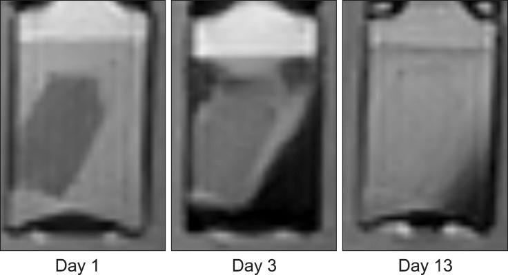 https://cdn.ncbi.nlm.nih.gov/pmc/blobs/98dc/4808634/4ce615fb9917/jvs-17-103-g005.jpg