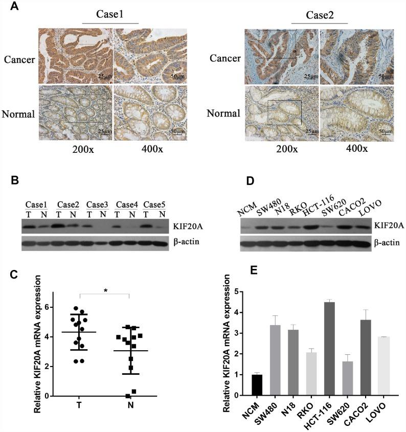 https://cdn.ncbi.nlm.nih.gov/pmc/blobs/98dc/6949076/ded2b521a1e3/aging-11-102505-g003.jpg