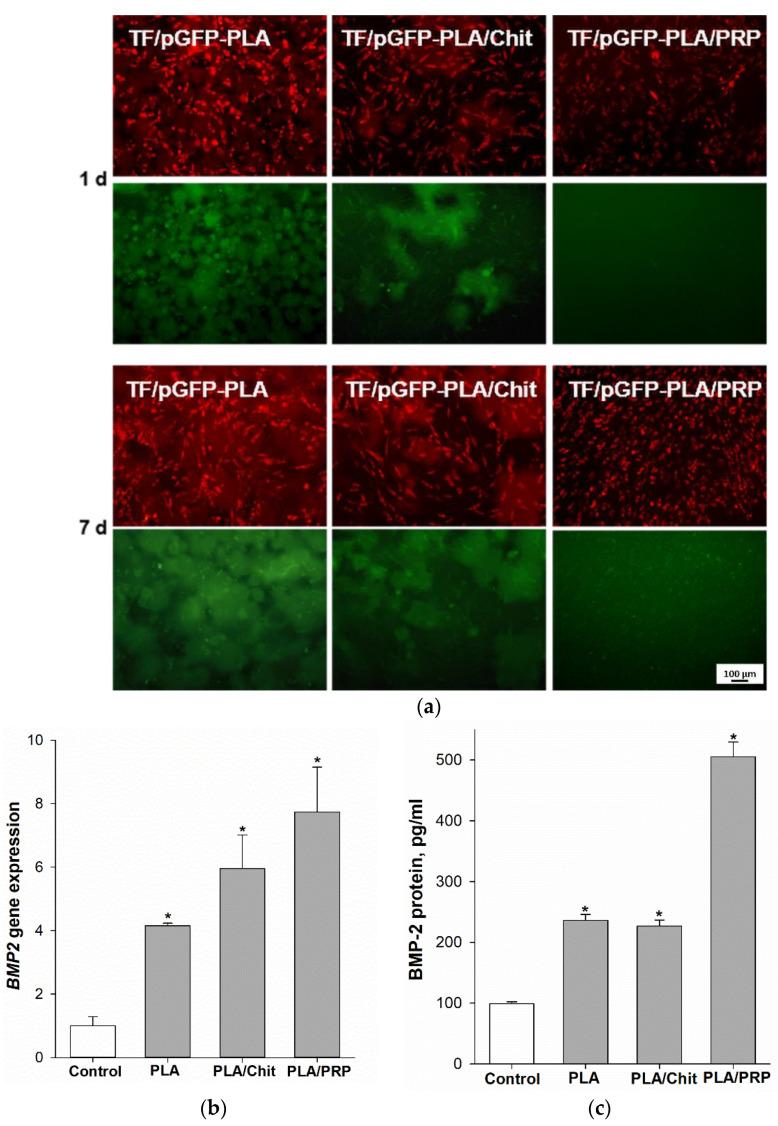 https://cdn.ncbi.nlm.nih.gov/pmc/blobs/98dd/9735524/be47b166f947/ijms-23-14720-g005.jpg