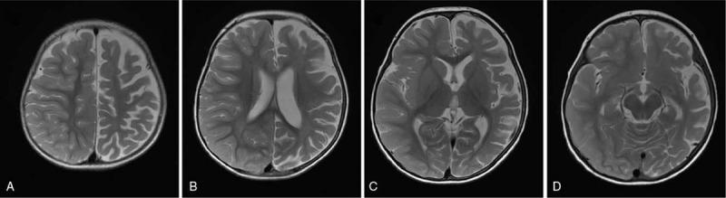 https://cdn.ncbi.nlm.nih.gov/pmc/blobs/98df/8183818/259a3b549163/medi-100-e25468-g002.jpg