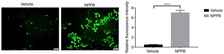 https://cdn.ncbi.nlm.nih.gov/pmc/blobs/98e9/7910017/7c50c9dd3230/IJMM-47-04-04892-g04.jpg