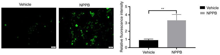 https://cdn.ncbi.nlm.nih.gov/pmc/blobs/98e9/7910017/f2984de00163/IJMM-47-04-04892-g03.jpg