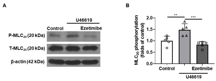 https://cdn.ncbi.nlm.nih.gov/pmc/blobs/98ed/10531054/702787f2a082/ijms-24-13992-g006.jpg