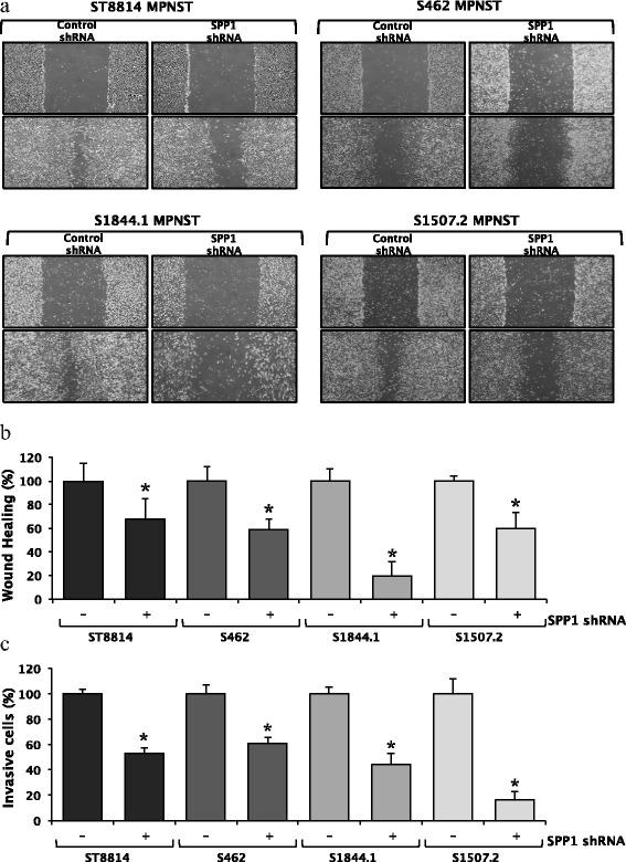 https://cdn.ncbi.nlm.nih.gov/pmc/blobs/98f5/4367978/0348d677e407/40246_2015_25_Fig4_HTML.jpg