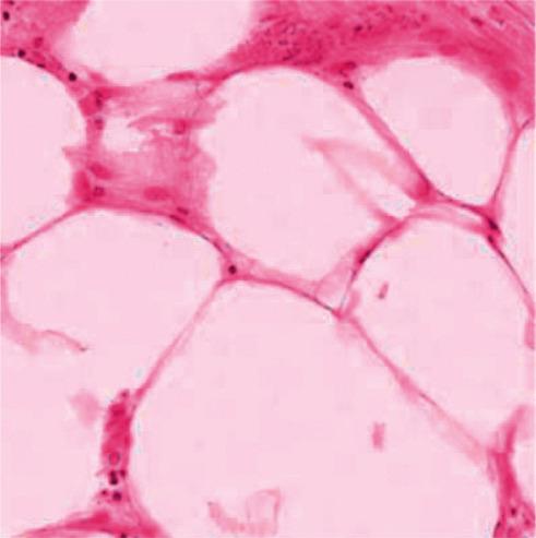 https://cdn.ncbi.nlm.nih.gov/pmc/blobs/98fd/9452942/7e31490d958a/CIN2022-4600840.004.jpg