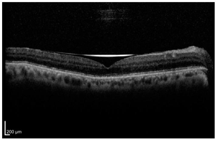 https://cdn.ncbi.nlm.nih.gov/pmc/blobs/98ff/11988441/344b33757497/diagnostics-15-00871-g001.jpg