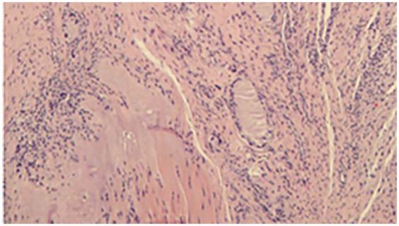 https://cdn.ncbi.nlm.nih.gov/pmc/blobs/9901/12106300/c5eb4aaa214f/fsurg-12-1503085-g004.jpg