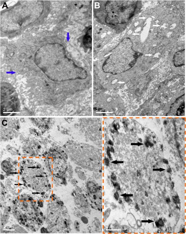 https://cdn.ncbi.nlm.nih.gov/pmc/blobs/9903/4228079/9d8ef1163ca8/12885_2014_4974_Fig9_HTML.jpg