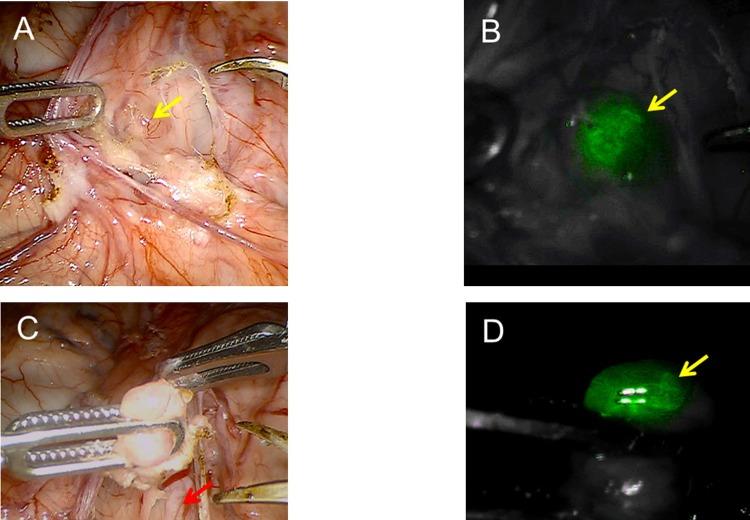 https://cdn.ncbi.nlm.nih.gov/pmc/blobs/9907/6028102/e151f9ed1f49/pone.0197842.g003.jpg