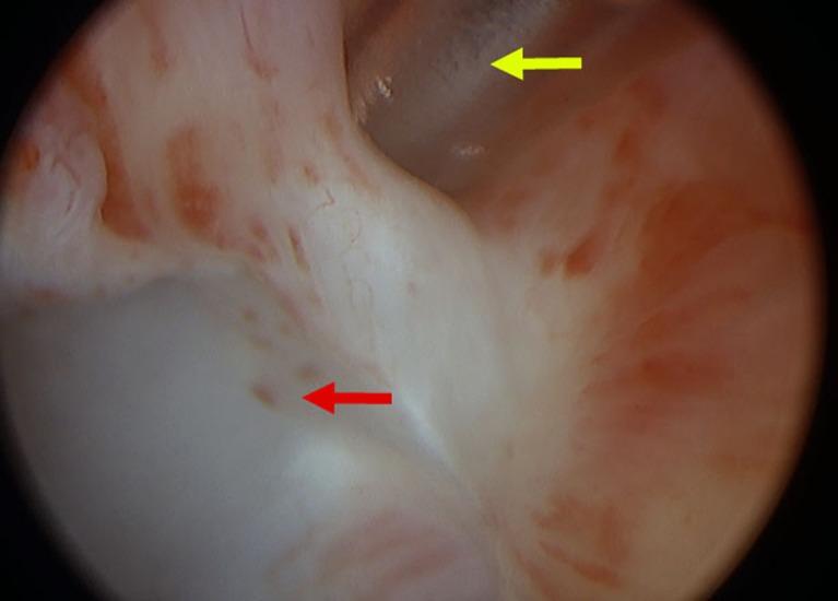 https://cdn.ncbi.nlm.nih.gov/pmc/blobs/9907/6028102/e584b6fe4e76/pone.0197842.g001.jpg