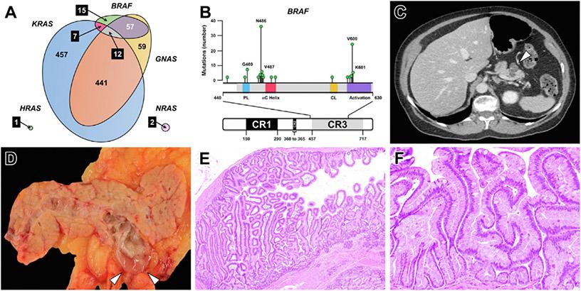 https://cdn.ncbi.nlm.nih.gov/pmc/blobs/990c/9844531/9fd37e861b1e/nihms-1859817-f0003.jpg