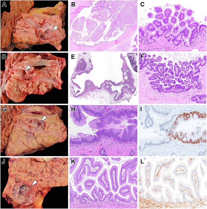 https://cdn.ncbi.nlm.nih.gov/pmc/blobs/990c/9844531/eda218feb556/nihms-1859817-f0005.jpg