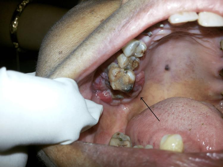https://cdn.ncbi.nlm.nih.gov/pmc/blobs/990e/10124672/a594541a0a67/cureus-0015-00000036671-i01.jpg