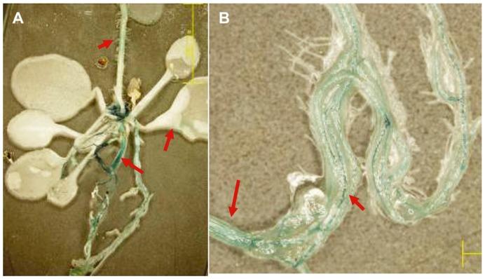 https://cdn.ncbi.nlm.nih.gov/pmc/blobs/9910/3519487/2b93aaa66ac3/pone.0051091.g003.jpg