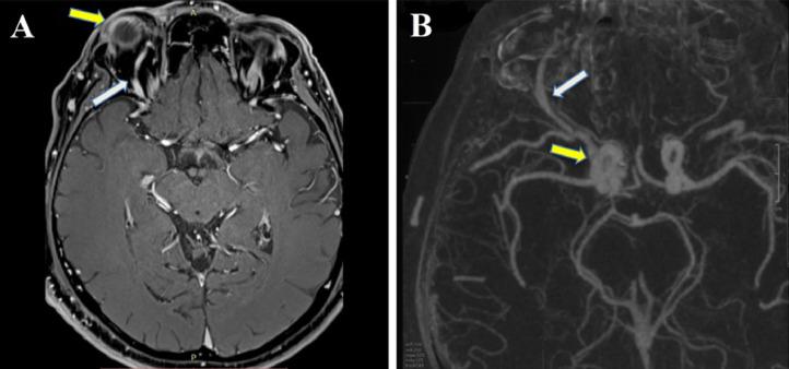 https://cdn.ncbi.nlm.nih.gov/pmc/blobs/9917/9283805/7edef802fb58/gr1.jpg