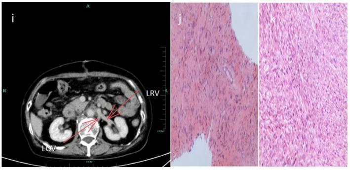 https://cdn.ncbi.nlm.nih.gov/pmc/blobs/9918/12405095/cdf9efe64dc7/12672_2025_3552_Fig4_HTML.jpg