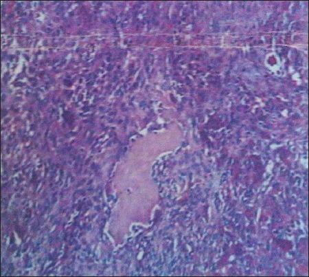 https://cdn.ncbi.nlm.nih.gov/pmc/blobs/991b/4038868/c9af376271da/AJNS-9-48-g003.jpg