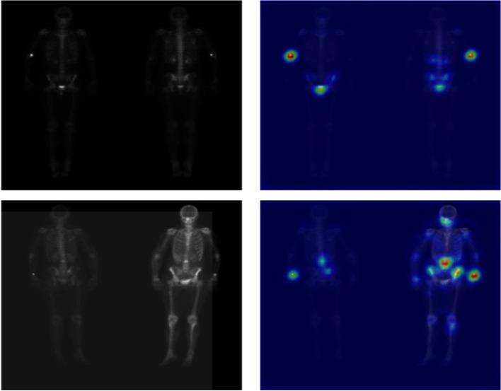 https://cdn.ncbi.nlm.nih.gov/pmc/blobs/9920/9875407/cb27674491ad/40644_2023_524_Fig6_HTML.jpg