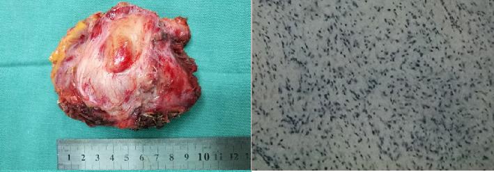 https://cdn.ncbi.nlm.nih.gov/pmc/blobs/9936/11991836/4c7f069f7921/CRIGM2025-6882566.005.jpg