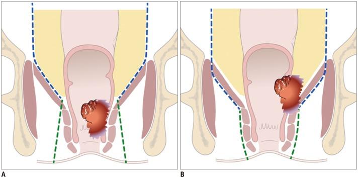 https://cdn.ncbi.nlm.nih.gov/pmc/blobs/9938/6609432/072e0124ad43/kjr-20-1003-g001.jpg