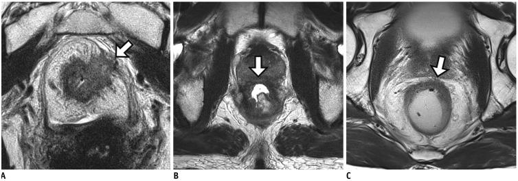 https://cdn.ncbi.nlm.nih.gov/pmc/blobs/9938/6609432/790a0691e12e/kjr-20-1003-g008.jpg