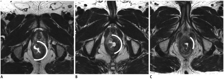 https://cdn.ncbi.nlm.nih.gov/pmc/blobs/9938/6609432/7a9f6705c5df/kjr-20-1003-g004.jpg
