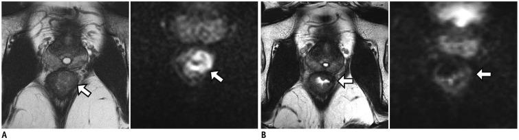 https://cdn.ncbi.nlm.nih.gov/pmc/blobs/9938/6609432/a5ec18a9cfb8/kjr-20-1003-g012.jpg