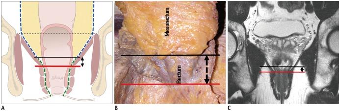 https://cdn.ncbi.nlm.nih.gov/pmc/blobs/9938/6609432/b63fb8fa0ba6/kjr-20-1003-g002.jpg