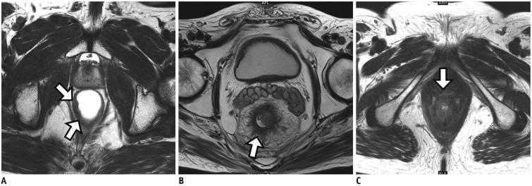 https://cdn.ncbi.nlm.nih.gov/pmc/blobs/9938/6609432/d64625c54756/kjr-20-1003-g006.jpg