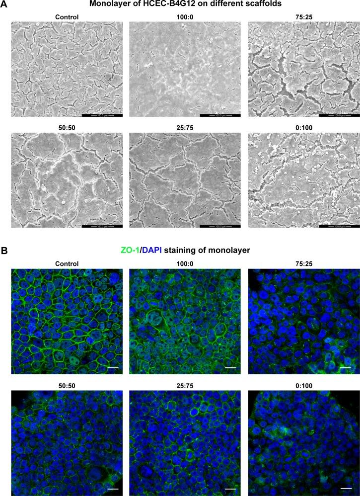 https://cdn.ncbi.nlm.nih.gov/pmc/blobs/993a/4427599/a6f0fb433b55/ijn-10-3337Fig4.jpg