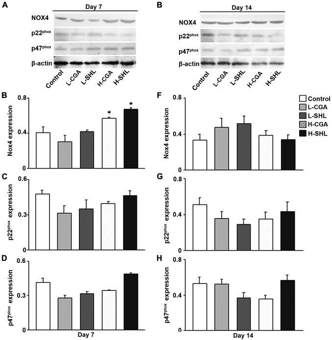 https://cdn.ncbi.nlm.nih.gov/pmc/blobs/993c/6125947/9657a0fbff03/etm-16-04-2901-g04.jpg